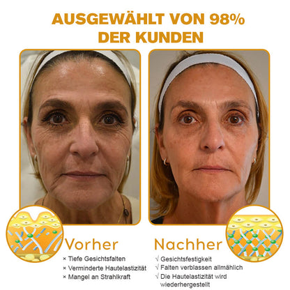 🌟Hergestellt in Deutschland✨Furzero™ Botox Bienenvenom Faltencreme🔥Letzter Tag der Aktion! 70 % Rabatt