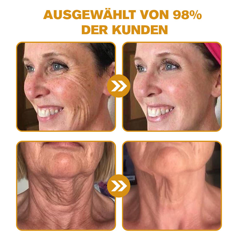 🌟Hergestellt in Deutschland✨Furzero™ Botox Bienenvenom Faltencreme🔥Letzter Tag der Aktion! 70 % Rabatt