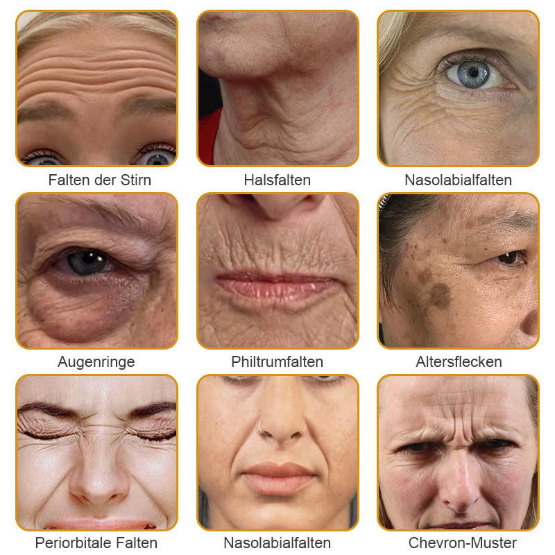 🌟Hergestellt in Deutschland✨Furzero™ Botox Bienenvenom Faltencreme🔥Letzter Tag der Aktion! 70 % Rabatt