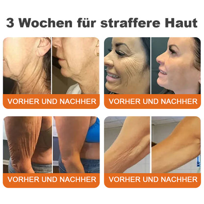 🍀🌟🌟Hergestellt in Deutschland✨Flysmus™ Botox-Bienenvergiftungsstraffungsserum-Stick🔥LETZTER TAG 70% RABATT