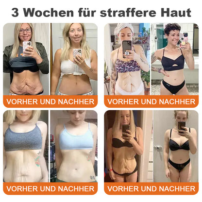 🍀🌟🌟Hergestellt in Deutschland✨Flysmus™ Botox-Bienenvergiftungsstraffungsserum-Stick🔥LETZTER TAG 70% RABATT